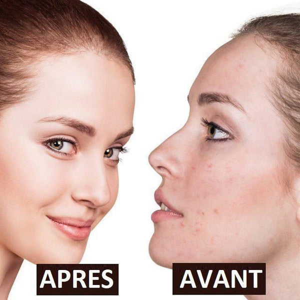 Masseur 5 en 1 à lumière haute fréquence